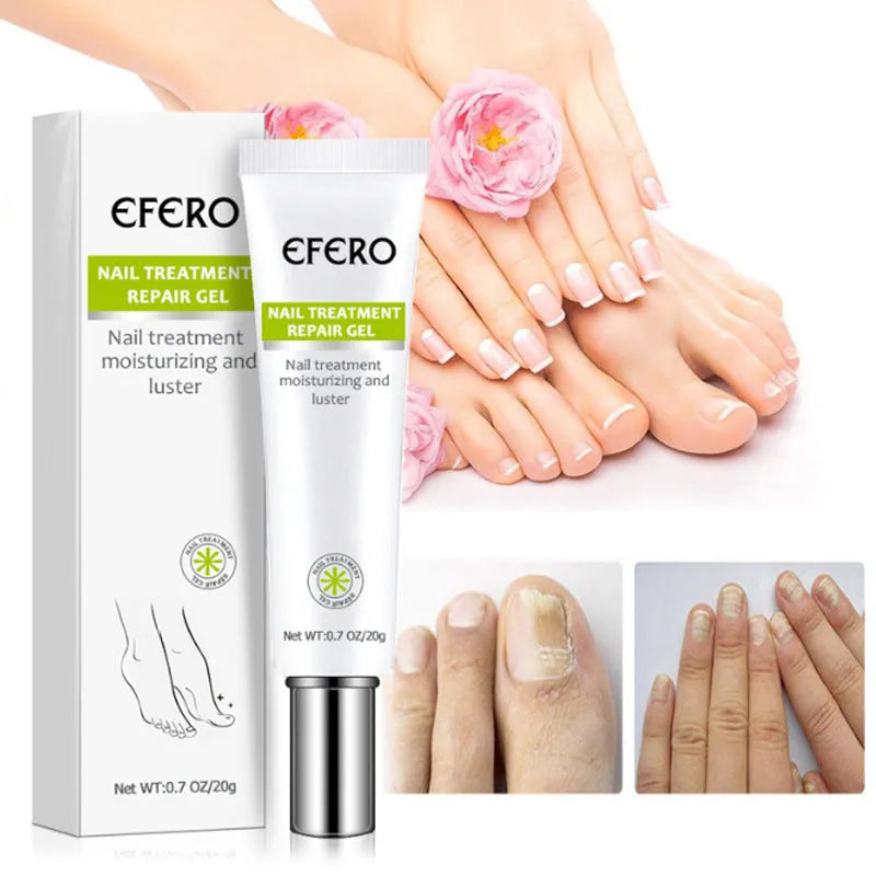 Traitement des ongles Sérum Pied de ongles Fongus de champign