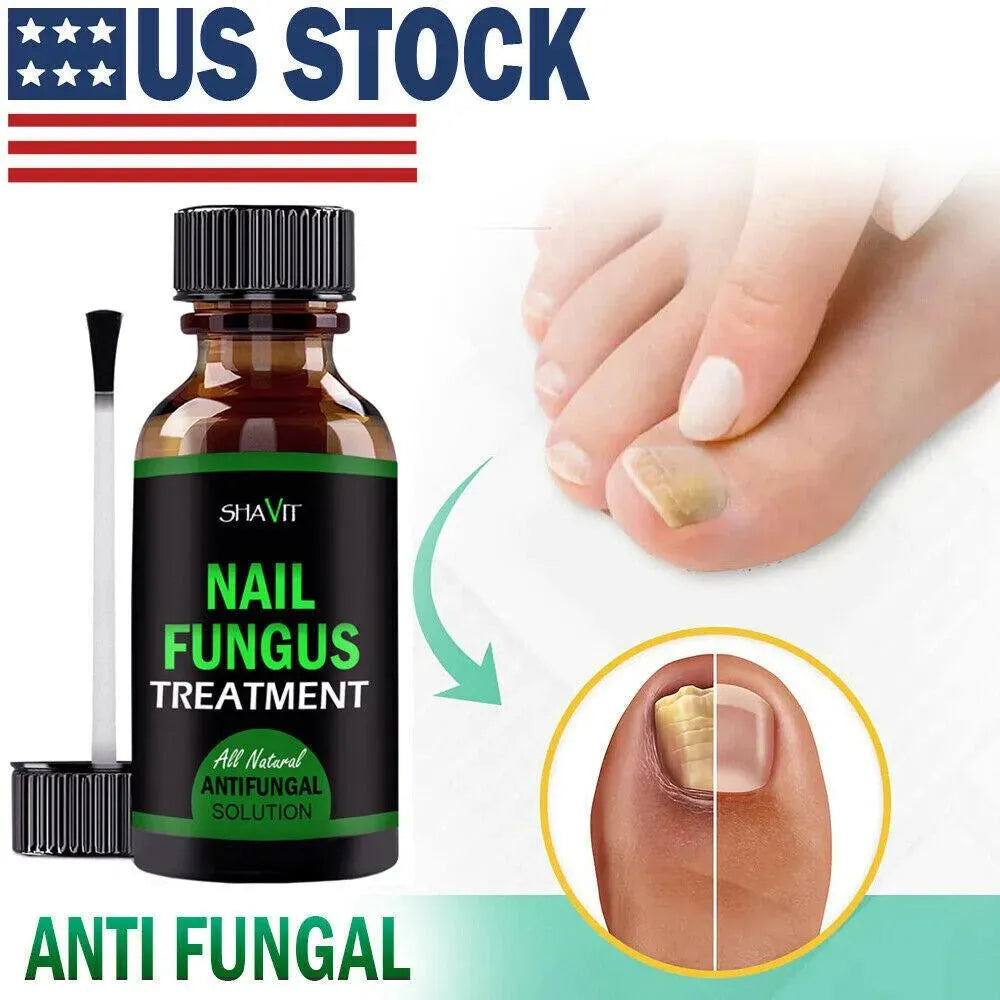 ANTI FUNGAL TREATMENT EXTRA STRENGTH TOENAIL FUNGUS ATHLETES FOOT FUNGI NAIL - EX-STOCK CANADA