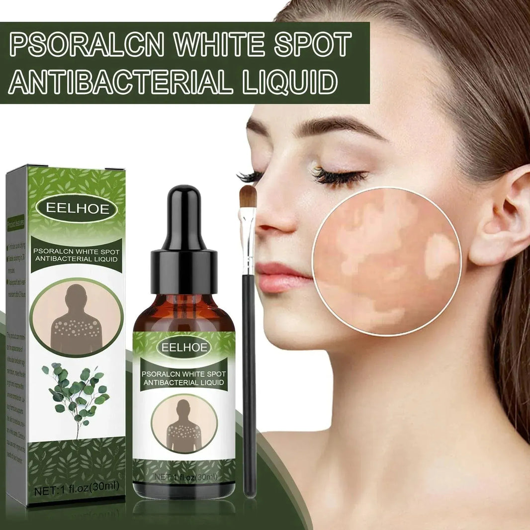 EELHOE White Spot Cleansing Serum PSORALCN White Spot Antibacterial Liquid. - EX-STOCK CANADA