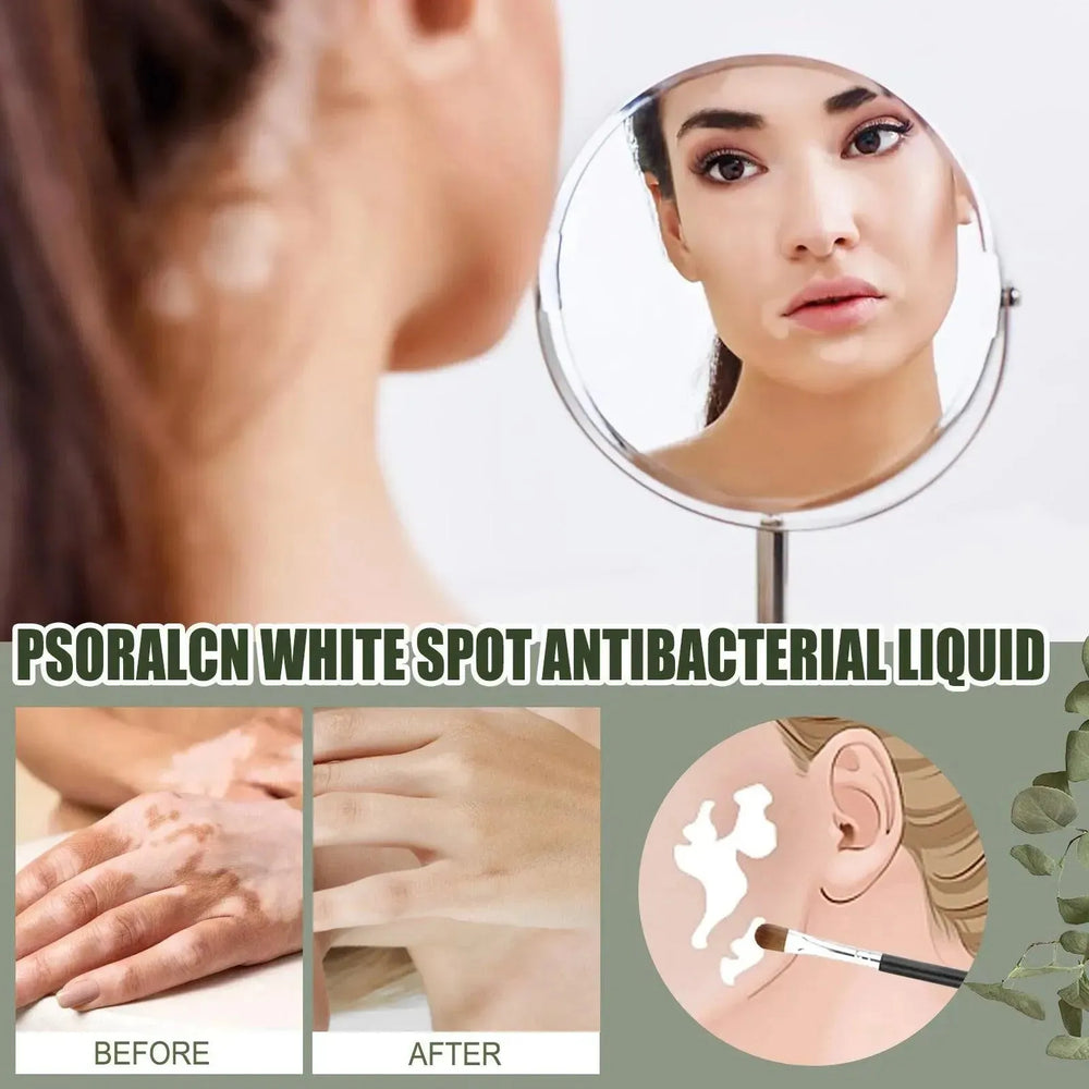 EELHOE White Spot Cleansing Serum PSORALCN White Spot Antibacterial Liquid. - EX-STOCK CANADA