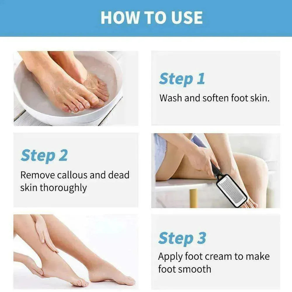 Foot Rasp File Callus Remover Pedicure Dead Hard Skin Scraper Tool - EX-STOCK CANADA