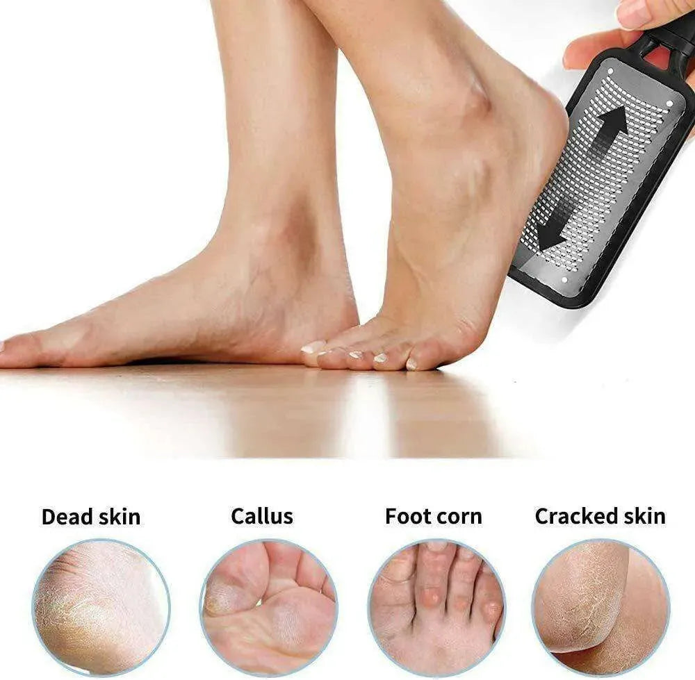 Foot Rasp File Callus Remover Pedicure Dead Hard Skin Scraper Tool - EX-STOCK CANADA