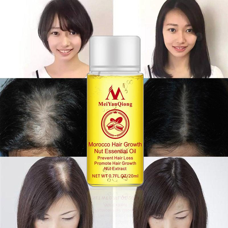 Hair Care Essential Oil , Promote Hair Growth, Shinny smooth texture, Moisturizes hair - EX-STOCK CANADA