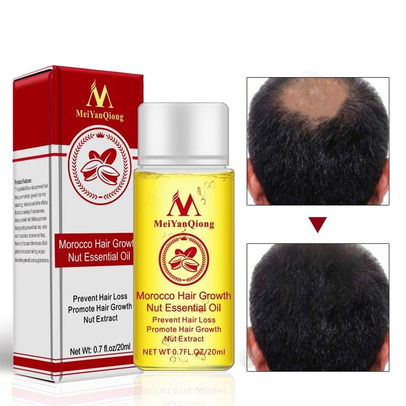Hair Care Essential Oil , Promote Hair Growth, Shinny smooth texture, Moisturizes hair - EX-STOCK CANADA